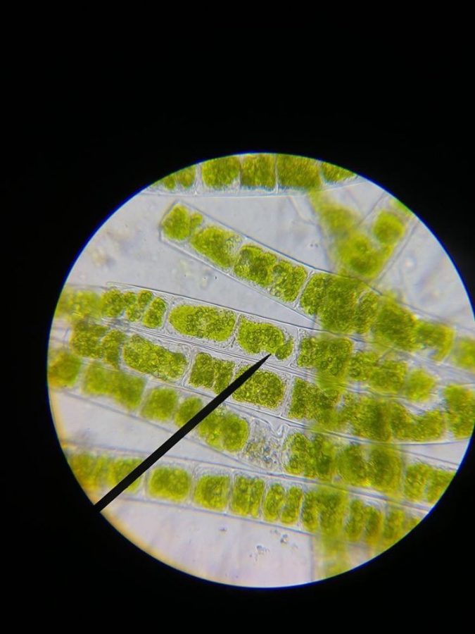 Microspora algae is viewed at 400x through a microscope.