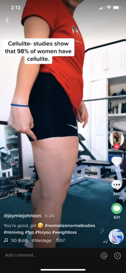 A TikTok shows a woman showing her cellulite, stating how normal it is for women to have it.